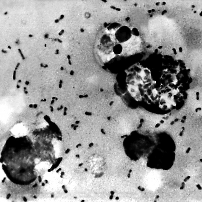 Magyarország sem áll jól a szuperbaktériumok elleni háborúban