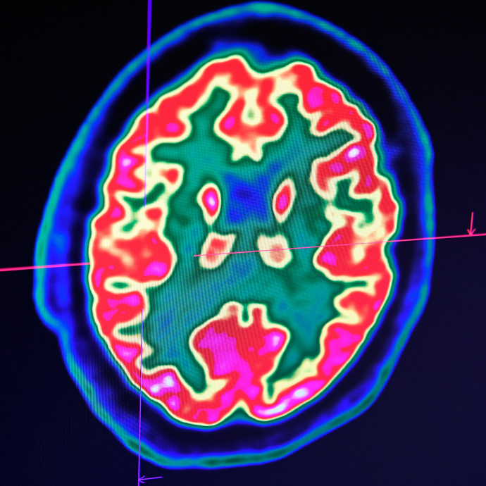 Az ember nem számológép, de attól még nem kell eldobni a közgazdaságtant