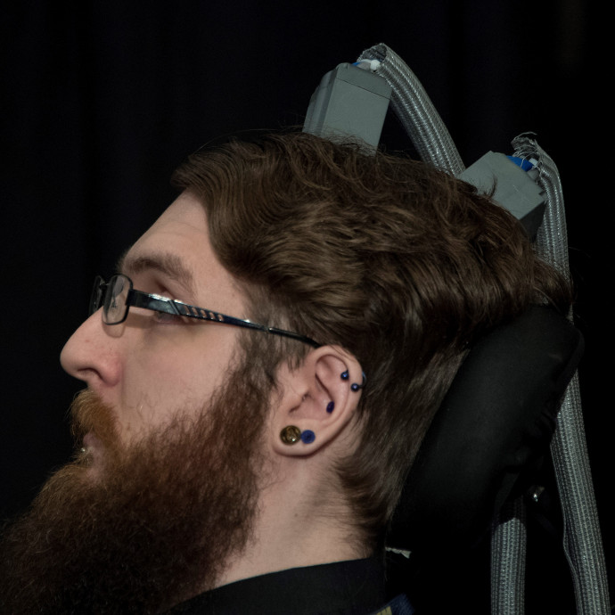 Agyba ültetett csipekkel turbózzák fel a memóriát