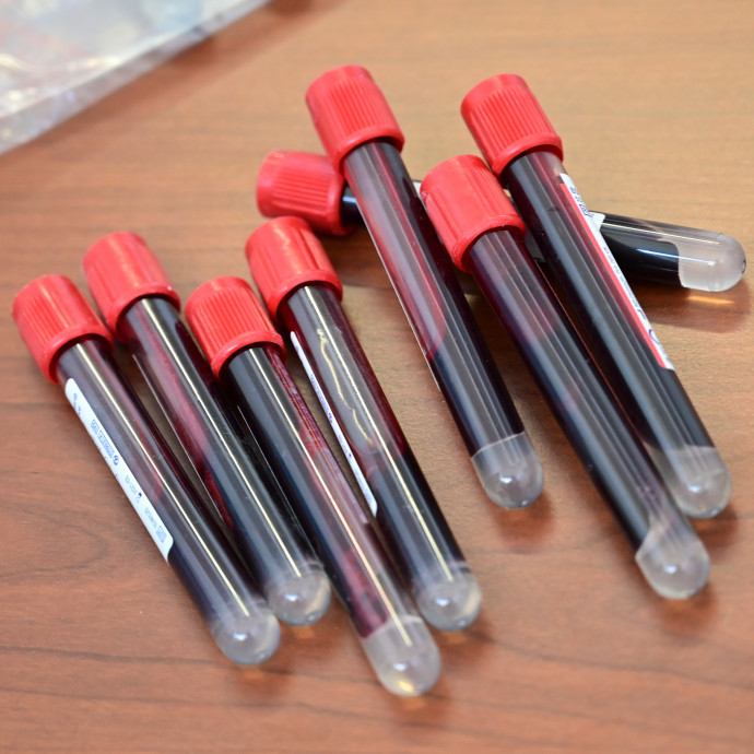 Kínai kutatás mutatja, hogy a járvány tetőpontja utáni, de oltás előtti időszak is nehéz lesz