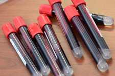 Kínai kutatás mutatja, hogy a járvány tetőpontja utáni, de oltás előtti időszak is nehéz lesz