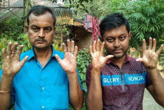 Születése óta nincs ujjlenyomata egy bangladesi család férfitagjainak, rengeteg megpróbáltatáson kell emiatt keresztülmenniük