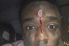 Elkezdett vérezni a rapper homloka a beleműtött hatalmas rózsaszín gyémánttól, arról panaszkodott, meg is halhat miatta
