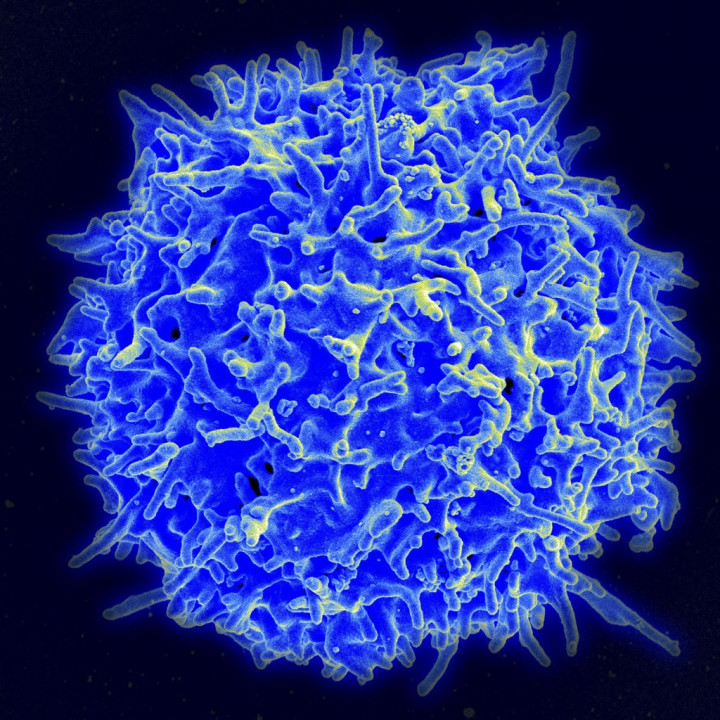 A NIAID által 2021. március 31-én közreadott fotó egy egészséges ember T-sejtjéről (T-limfocita) – Fotó: NIAID/AFP