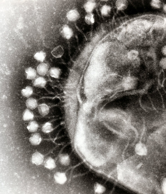 Egy baktériumhoz kapcsolódó bakteriofág vírusok egy elektronmikroszkóppal készült felvételen – Fotó: Dr. Graham Beards / Wikimedia Commons