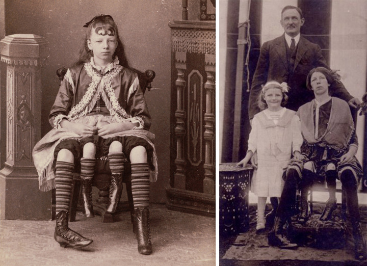 Balra Myrtle Corbin kislányként 1882-ben – Fotó: Charles Eisenmann / WikipediaJobbra pedig férjével és lányával látható az 1890-es évek elején – Fotó: Wikipedia