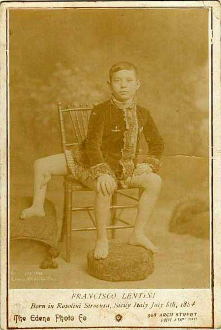 Frank Lentini gyerekkori fotója – Forrás: Wikipedia