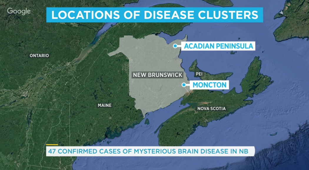 A kanadai Új-Brunswick tartomány térképe, kiemelve az esetek két gócpontját – Forrás: CTV Your Morning