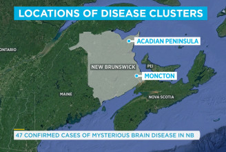 Hetekig titkolóztak a hatóságok Kanadában egy rejtélyes agykórról
