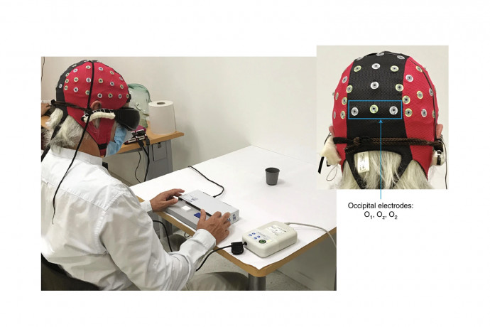 A tanulmányban bemutatott páciens egy vizuális teszt során, amelyben a viselkedése mellett EEG-vel mérték az agyi aktivitását is. Forrás: Sahel, JA., Boulanger-Scemama, E., Pagot, C. et al. / Nature Medicine