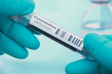 A járványhelyzet hatása a hazai magánegészségügyi szektorra