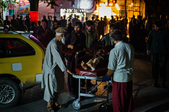 A robbantást követően a sérülteket a kabuli kórházba szállították – Fotók: Marcus Yam / Los Angeles Times / Getty Images