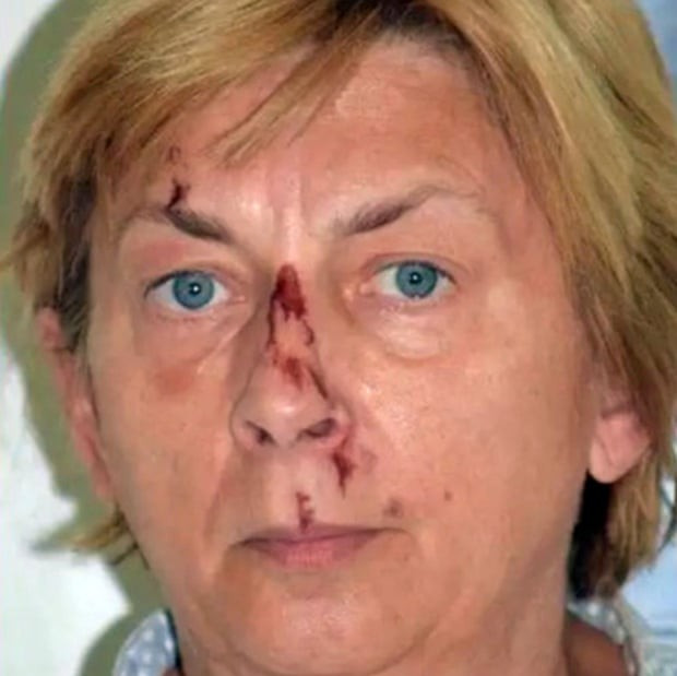 A rendőrség által kiadott fotó szerint a nő így nézett ki, mikor rátaláltak – Fotó: PU primorsko-goranska