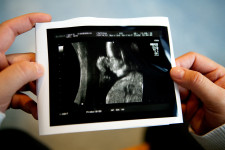 Kína tovább korlátozza az abortuszt, állításuk szerint a nők érdekében teszik