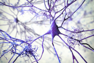 Nem engedélyezik az EU-ban a kétes hatásosságú Alzheimer-gyógyszert