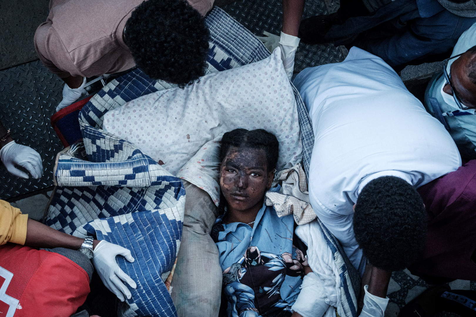 Egy közeli falu sebesült lakóját viszik hordágyon Mekelébe, az etiópiai Tigré régió legfontosabb városába 2021. június 23-án. A parlamenti választások után egy nappal ért légicsapás egy piacot a faluban – Fotó: Yasuyoshi Chiba / AFP
