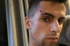 Megverték és kirabolták a Manchester City portugál válogatott futballistáját