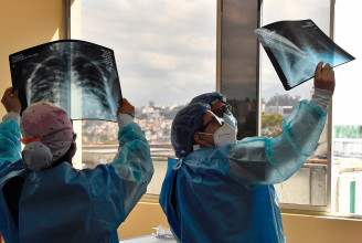 A Bataclan elleni támadás egyik túlélőjének röntgenfelvételét NFT-ként akarta értékesíteni a sebésze