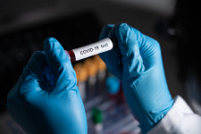 Önkénteseket keres az Oxford Egyetem, hogy megfertőzze őket a koronavírussal