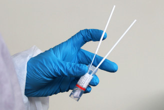 Fact-check: A CDC nem azért vonatta vissza egy RT-PCR-teszt engedélyét, mert összekeverte a koronavírust az influenzával