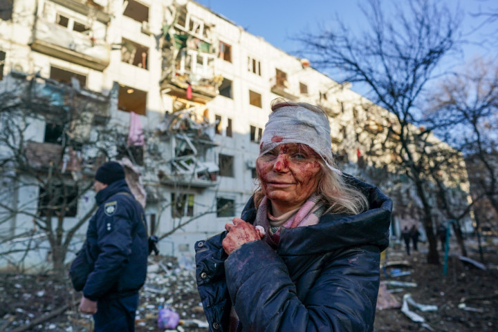 Légicsapás során megsérült nő a Harkov megyei Csuhuivban – Fotó: Anadolu Agency / Getty Images