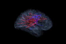 Új gépi tanulásos módszert fejlesztettek ki az ELTE kutatói az emberi agy kapcsolatainak leírásait felhasználva
