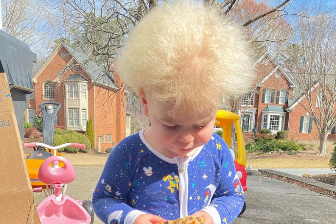 Cukinak tűnt, hogy van egy kisfiú, akinek nem lehet megfésülni a haját, de kiderült, hogy ez egy ritka genetikai rendellenesség jele