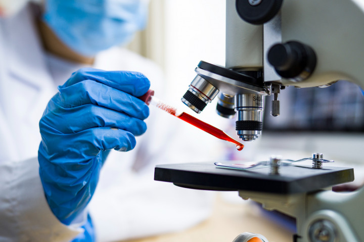 Először találtak a kutatók mikroműanyagot az emberi vérben