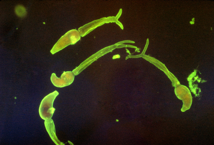 Schistosoma lárvák – Fotó: Smith Collection / Gado / Getty Images