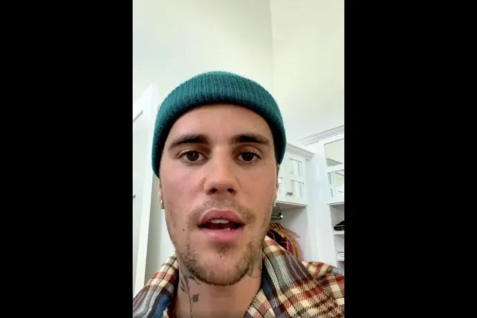 Justin Bieber szerint Jézus segít neki meggyógyulni az arcbénulásból