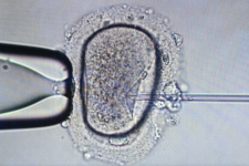 Az egyszerűbb meddőségi kezeléseket a megyei kórházakra bízhatja a kormány