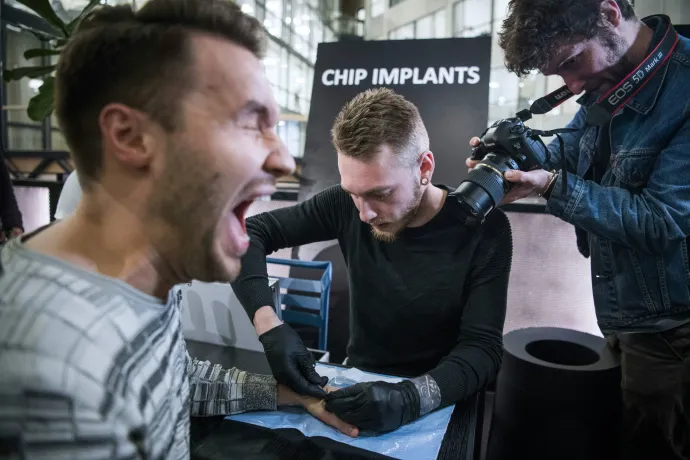 Implantátumot ültetnek egy résztvevő kézfejébe a stockholmi Epicenterben, egy 2018-as csiptechnológiai rendezvényen – Fotó: Jonathan Nackstrand / AFP