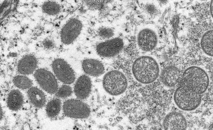 Majomhimlő vírus elektronmikroszkópos képe – Fotó: Cynthia S. Goldsmith / Russell Regnery / Centers for Disease Control and Prevention