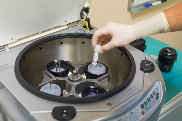 Egy tanulmány szerint több mint felére csökkent a férfiak spermiumszáma ötven év alatt