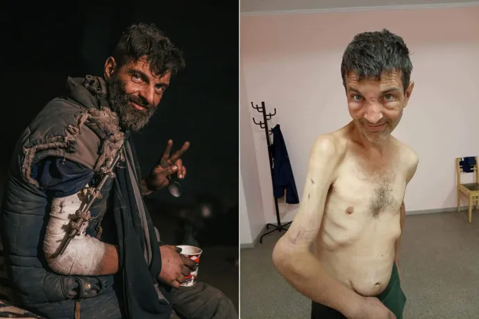 Mihajlo Gyanov, az Azovsztal védője sérült karral az acélmű alatti óvóhelyen, majd a megadást és a fogolycserét követően 2022. szeptember 23-án – Fotó: Handout / AFP; Ukrán Védelmi Minisztérium / Twitter
