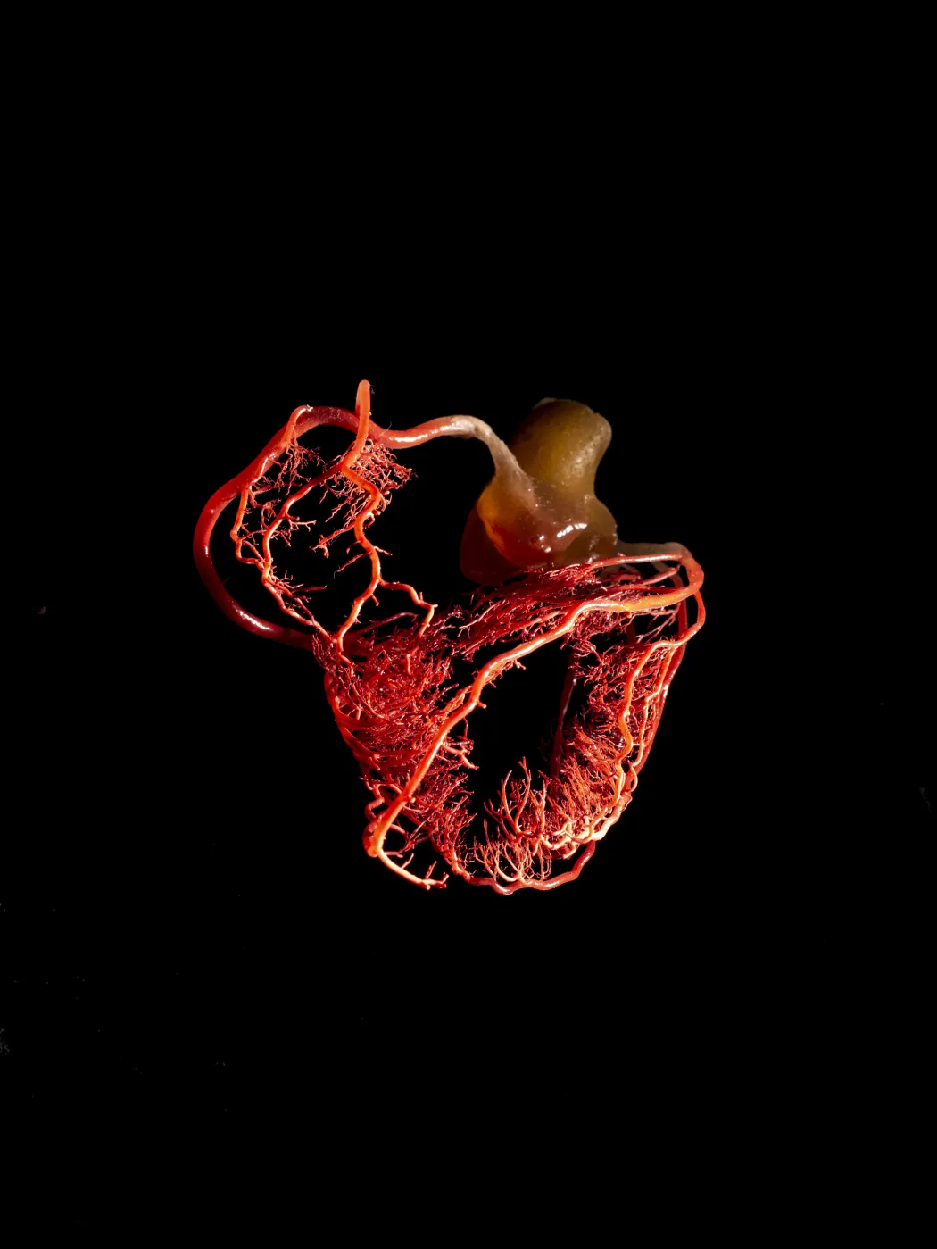 Az emberi szív koszorús ereit és azoknak a főverőérből (aorta) való eredését bemutató színezett öntvény