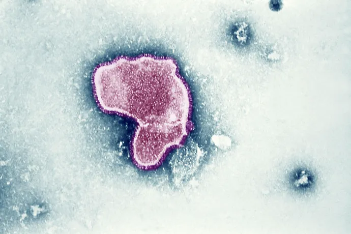 Egy RSV vírus elektronmikroszkópos képe – BSIP / UIG / Getty Images
