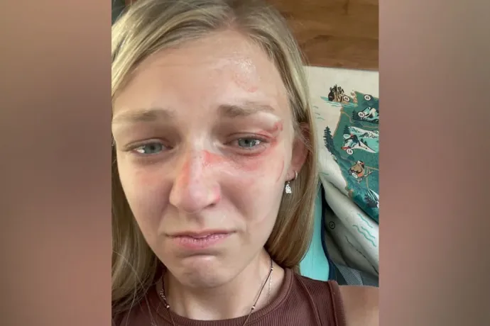 A meggyilkolt Gabby Petito sérült, monoklis arcát ábrázoló szelfi bizonyíthatja a rendőrség komoly mulasztását