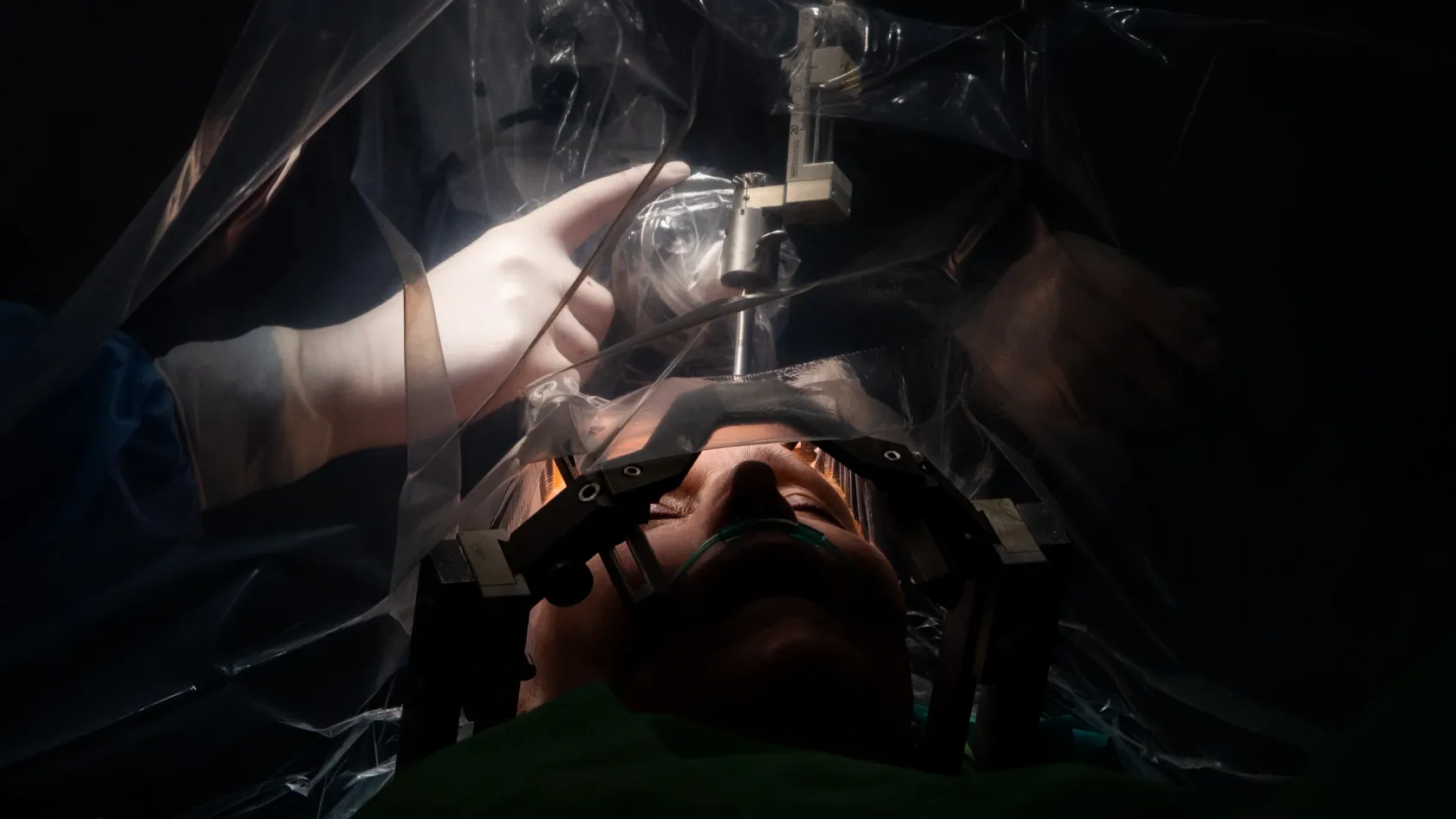 Élőben nézhettük végig, ahogy megmetszik valaki agydaganatát