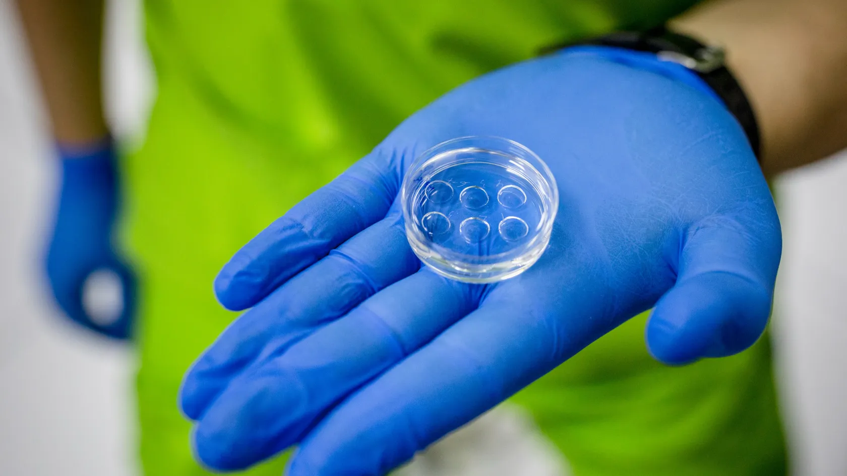 A meddőség nem válogat: több millió embert érint a terméketlenség a WHO friss jelentése szerint