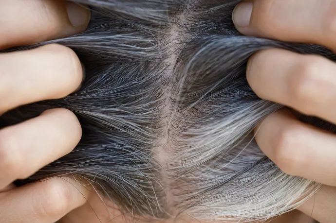 Beragadt sejtek állhatnak az őszülés mögött