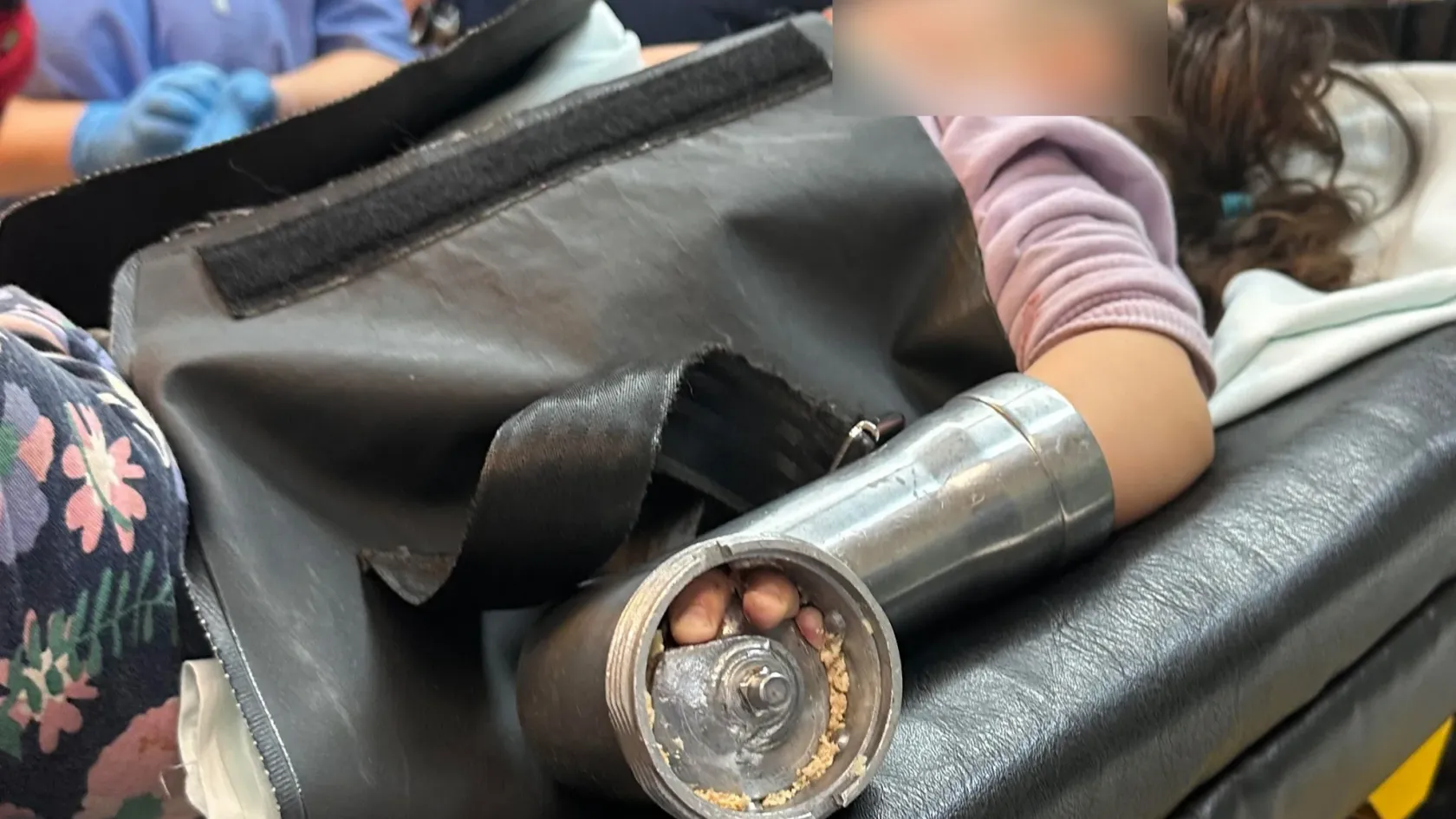 Húsdarálóba szorultak egy kétéves kislány ujjai, megmentették az orvosok a kezét
