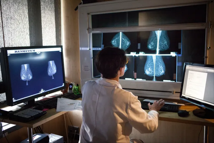 Tavaly kilenc megyében egyáltalán nem végeztek CNAS által támogatott mammográfiát