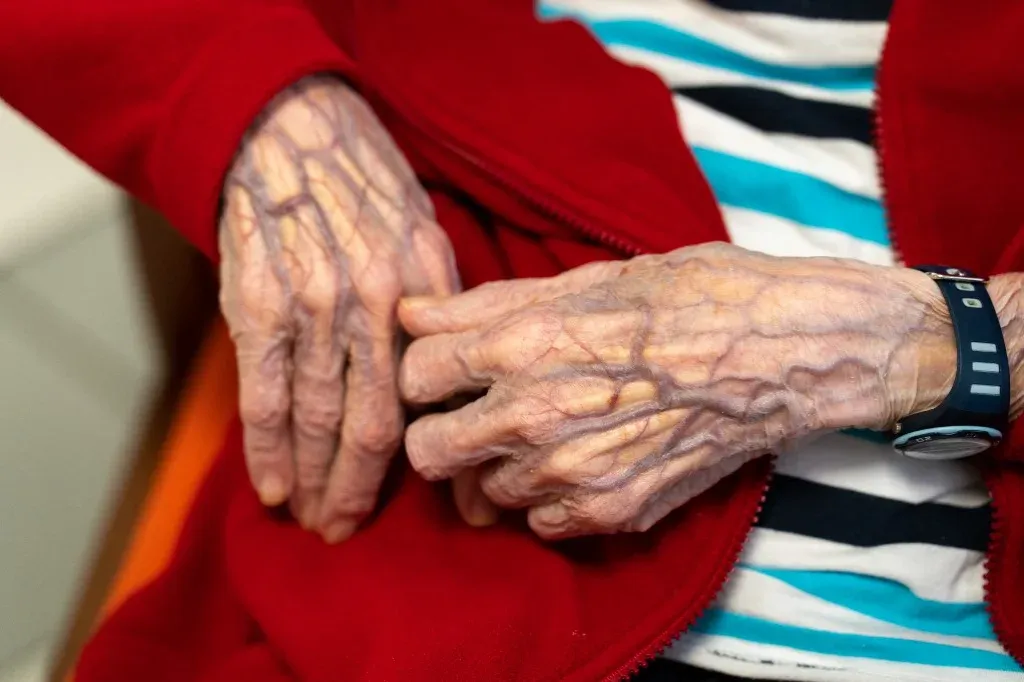 Jelentősen lassíthatja a leépülést egy új Alzheimer-gyógyszer, de veszélyes mellékhatása van