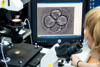Újabb változások jönnek a lombikbébiszektorban, a petesejt-donációt és az embriók genetikai vizsgálatát is rendezik