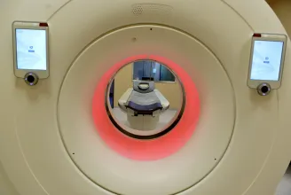 Nagyobb várólistát okozhat a CT-vizsgálatok államosítása az orvosi kamara szerint