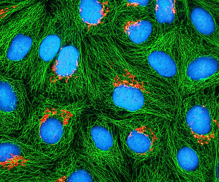 Multifoton fluoreszcens mikroszkóppal alkotott kép tenyésztett HeLa-sejtekről – Fotó: Nih / NIH / BSIP / Getty Images