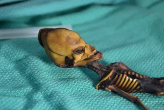Az Atacamai Alient földönkívülinek hitték, pedig valójában egy torzszülött volt