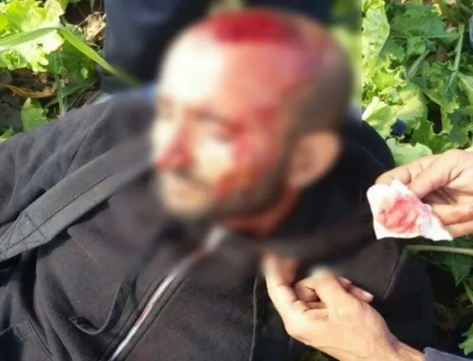 Khurram Shazad sérülései a bántalmazás után készült felvételen – Forrás: Magyar Helsinki Bizottság