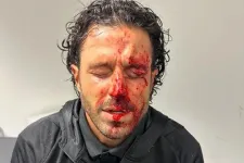 Brutális huligántámadás Marseille-ben, a Lyon edzője vérző fejjel szállt le a csapatbuszról
